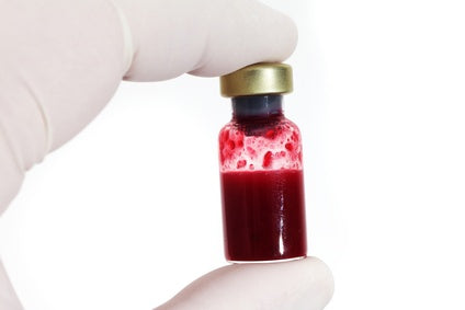 Gloved hand holding a vial of red blood